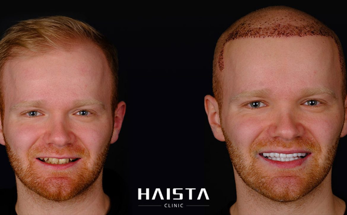 Home - Haista Clinic