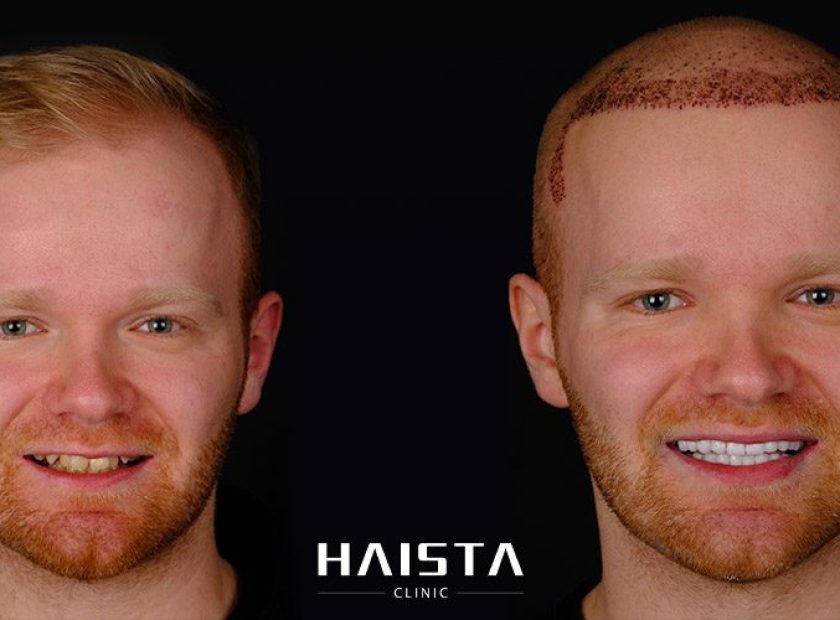 Home - Haista Clinic