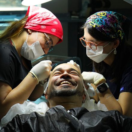 Will Hair Transplant Last Forever? - Haista Clinic